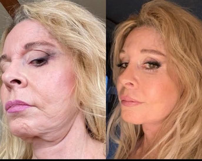 ✨Botoxmix bee venom firming serum stick🔥