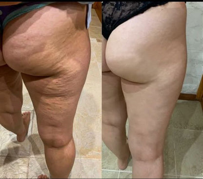 ✨Botoxmix bee venom firming serum stick🔥