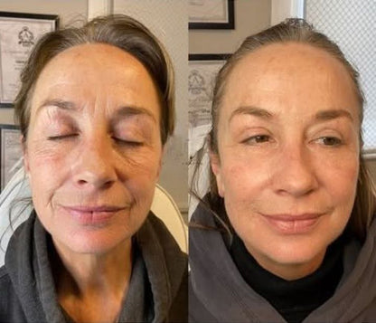 ✨Botoxmix bee venom firming serum stick🔥