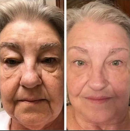 ✨Botoxmix bee venom firming serum stick🔥